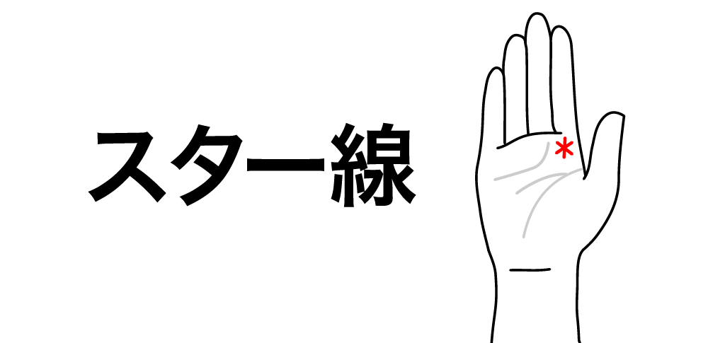 【スター線】が教える“幸運の星”|強運のタイミングを告げる神秘のサイン