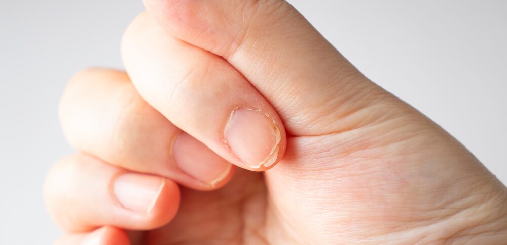 【夢占い】爪が割れる夢｜意味・メッセージなど40選を解説