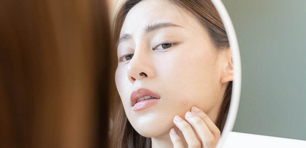 左頬のニキビのスピリチュアル的な意味は？｜状況・種類・性別・位置別など30選を解説